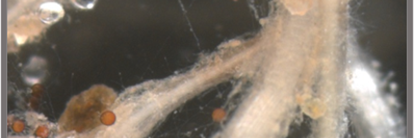 Arbuscular mycorrhizal fungi (AMF) on plant roots